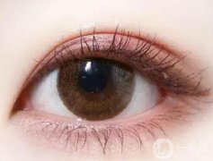 定點(diǎn)雙眼皮恢復(fù)需要多長(zhǎng)時(shí)間？