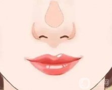 墊鼻梁多久能恢復(fù)？