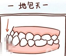 地包天是怎么形成的，可以矯正過(guò)來(lái)嗎？