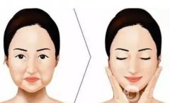 電波拉皮有用嗎？有什么果？