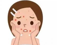 點(diǎn)陣激光后恢復(fù)正常需要多久，有哪些注意事項(xiàng)？