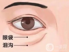 常見的淚溝填充的方法有哪些？