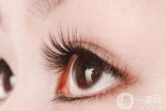 單眼皮可以嫁接睫毛嗎？種植睫毛有什么特點？