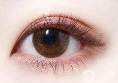 定點雙眼皮大概可以管多久？