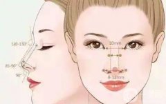 墊鼻梁的果會永遠維持嗎？