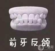 地包天能做手術(shù)糾正嗎？