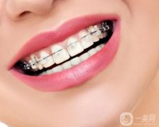 戴牙套后臉型有什么變化？