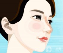 膨體隆鼻嗎？有沒有后遺癥？