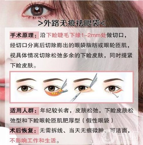 天津醫(yī)科大學(xué)眼科醫(yī)院做眼袋*果如何?價格價目表2020年全新公布