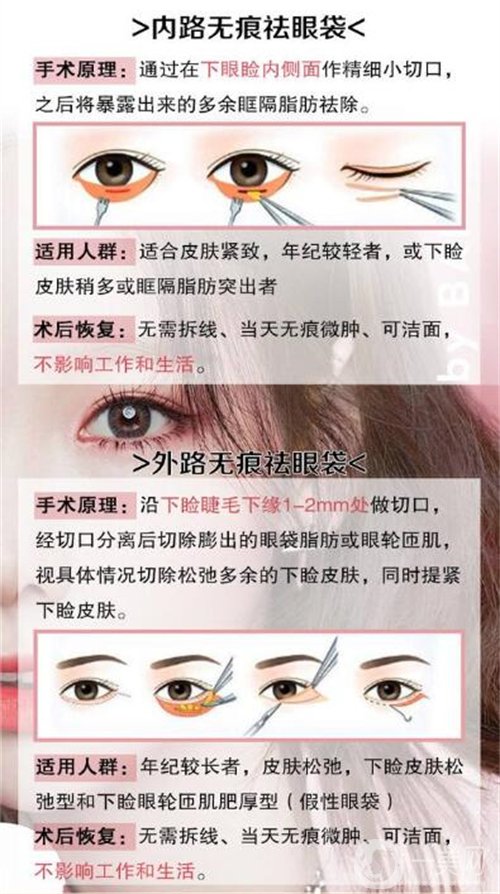 天津醫(yī)科大學(xué)眼科醫(yī)院做眼袋*果如何?價格價目表2020年全新公布
