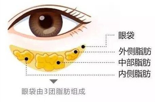 天津醫(yī)科大學(xué)眼科醫(yī)院做眼袋*果如何?價格價目表2020年全新公布