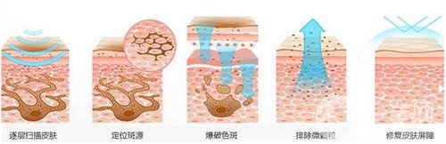 天津醫(yī)科大學(xué)腫瘤醫(yī)院整形科價格表，附激光祛斑恢復(fù)*果圖