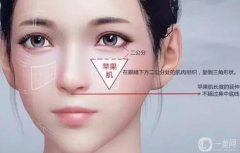 蘋(píng)果肌填充有什么后遺癥？