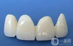烤瓷牙脫落如何修復(fù)？做烤瓷牙有哪些必要性？