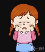 激光祛斑后有哪些需要注意?激光去斑果怎么樣？