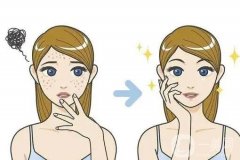 在祛痘手術(shù)調(diào)節(jié)前后有哪些需要注意的事項(xiàng)？