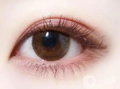 雙眼皮有哪些類型？割雙眼皮有哪些術(shù)前準(zhǔn)備？