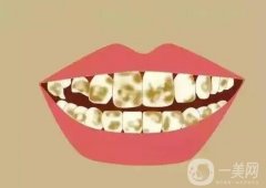 氟斑牙形成的原因有哪些，如何調(diào)節(jié)氟斑牙？