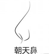 矯正朝天鼻很難嗎?