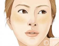 結(jié)痂有哪些注意事項(xiàng)?