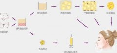 自體脂肪填充將來(lái)會(huì)消失嗎？