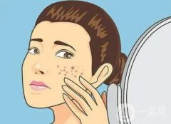 激光祛痘印后有疤痕的原因?