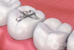 為什么補(bǔ)牙要趁早？