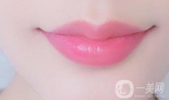 玻尿酸豐唇有什么特點(diǎn)?