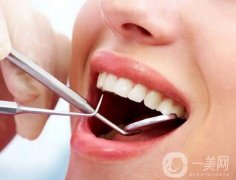 洗牙能美白牙齒嗎？洗牙對牙齒有害嗎？