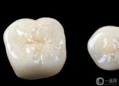 補牙洞使用什么材料好呢?