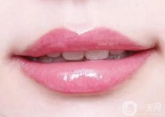 可以在注射嘟嘟唇后敷冰塊嗎？