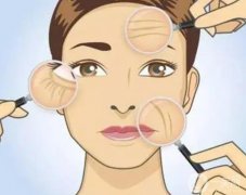 拉皮手術(shù)有哪幾種方法?