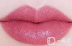 想要嘟嘟唇是注射玻尿酸嗎？