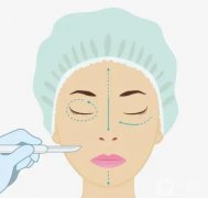 埋線雙眼皮有什么優(yōu)點(diǎn)和缺點(diǎn)，恢復(fù)正常需要多長時(shí)間?