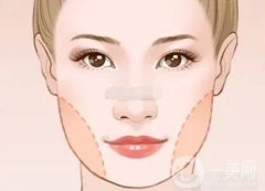 為什么面部吸脂要戴頭罩？