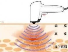 為什么熱拉提要連續(xù)做三次？