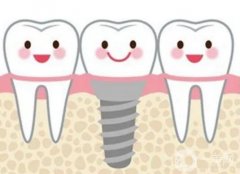 使用支抗釘有什么作用，打支抗釘痛嗎?