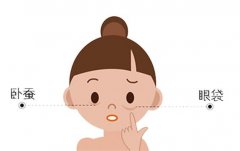 臥蠶去除手術(shù)需要多少錢？