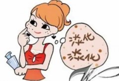 為什么激光能祛斑？激光祛斑會(huì)不會(huì)留下疤痕？