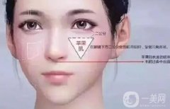 填充蘋果肌有哪些方法？
