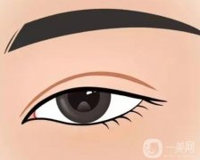 雙眼皮有哪些變寬的方法？