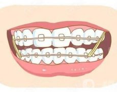 如何選擇矯正牙齒的醫(yī)院?