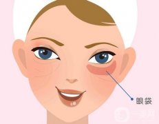 什么方法去除眼袋的果持久？