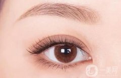 誰適合割雙眼皮，割雙眼皮后需要多長時(shí)間消腫？