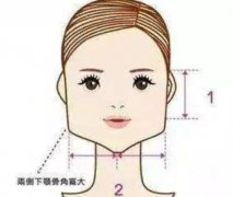 下頜角截骨術(shù)完全恢復(fù)需要多長時(shí)間？