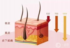 什么是激光？