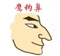 影響鷹鉤鼻矯正價(jià)格的因素有哪些？