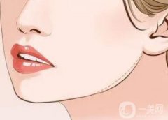 下頜角整容有副作用嗎？有哪些后遺癥？