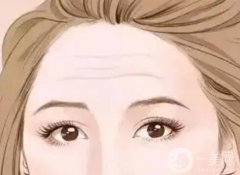 抬頭紋注射玻尿酸可以管多久？