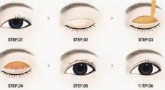 雙眼皮手術(shù)恢復(fù)需要多長時間？